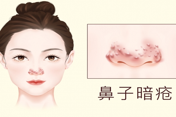 脸色暗沉发黑怎么才能变白