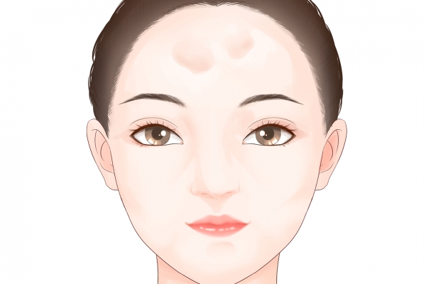 额头有皱纹怎么回事