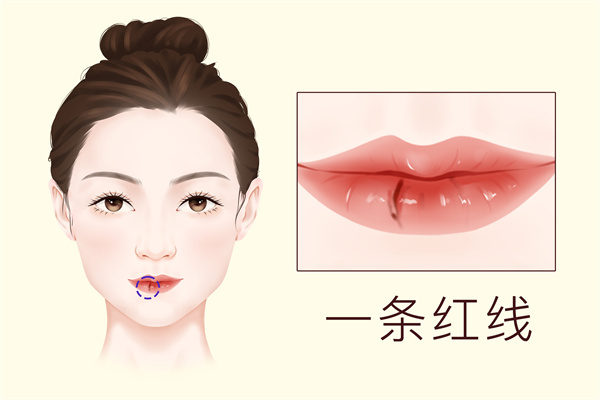 嘴唇整容费用是多少